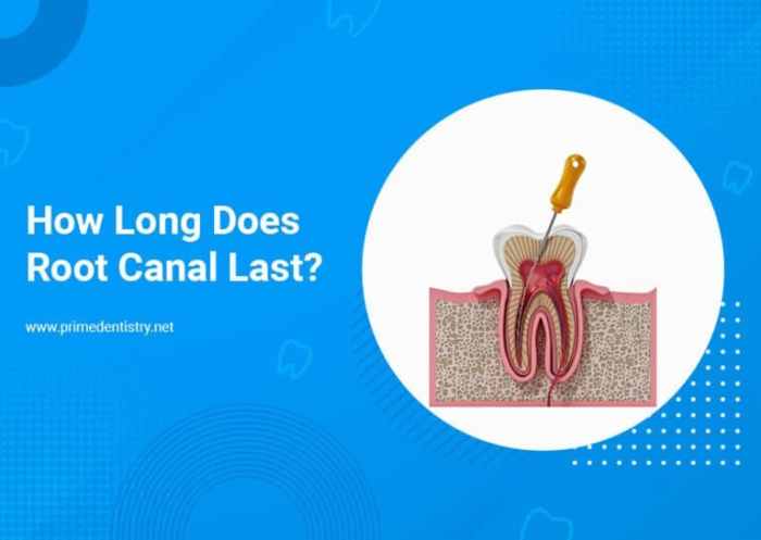 How long does a root canal take to heal